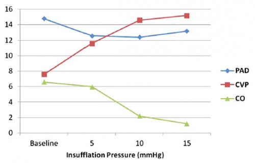 PhysioTamponnade.jpeg